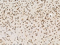 Invitrogen Galectin 7 Polyclonal Antibody 100 &mu;L; Unconjugated:Antibodies,