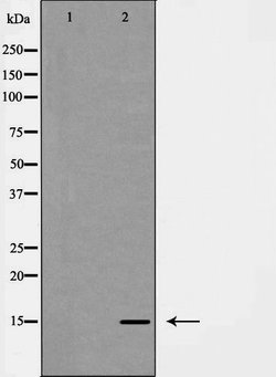 Invitrogen Galectin 7 Polyclonal Antibody 100 &mu;L; Unconjugated:Antibodies,