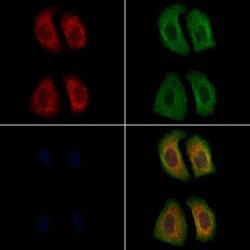 Invitrogen LHR Polyclonal Antibody 100 &mu;L; Unconjugated:Antibodies,