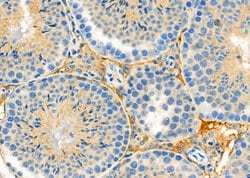 Invitrogen LHR Polyclonal Antibody 100 &mu;L; Unconjugated:Antibodies,