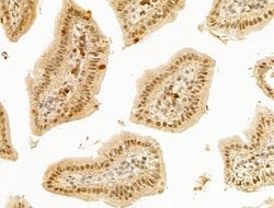 Invitrogen LHX6 Polyclonal Antibody 100 &mu;L; Unconjugated:Antibodies,