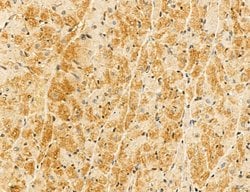 Invitrogen LIFR Polyclonal Antibody 100 &mu;L; Unconjugated:Antibodies,
