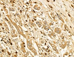 Invitrogen LIFR Polyclonal Antibody 100 &mu;L; Unconjugated:Antibodies,