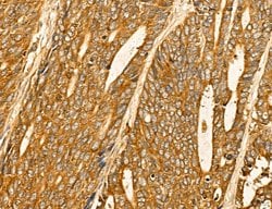 Invitrogen LIFR Polyclonal Antibody 100 &mu;L; Unconjugated:Antibodies,