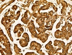 Invitrogen LIFR Polyclonal Antibody 100 &mu;L; Unconjugated:Antibodies,