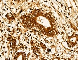 Invitrogen LIFR Polyclonal Antibody 100 &mu;L; Unconjugated:Antibodies,