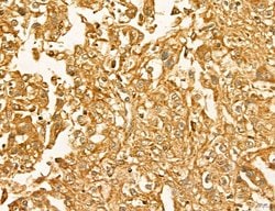 Invitrogen LIFR Polyclonal Antibody 100 &mu;L; Unconjugated:Antibodies,