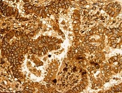 Invitrogen LIFR Polyclonal Antibody 100 &mu;L; Unconjugated:Antibodies,