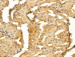 Invitrogen LIFR Polyclonal Antibody 100 &mu;L; Unconjugated:Antibodies,