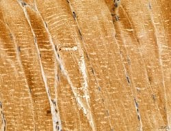 Invitrogen LIFR Polyclonal Antibody 100 &mu;L; Unconjugated:Antibodies,