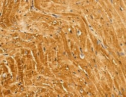 Invitrogen LIFR Polyclonal Antibody 100 &mu;L; Unconjugated:Antibodies,