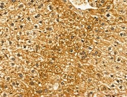Invitrogen LIFR Polyclonal Antibody 100 &mu;L; Unconjugated:Antibodies,