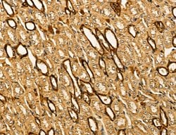 Invitrogen LIFR Polyclonal Antibody 100 &mu;L; Unconjugated:Antibodies,