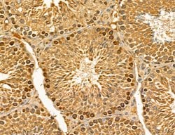 Invitrogen LIFR Polyclonal Antibody 100 &mu;L; Unconjugated:Antibodies,