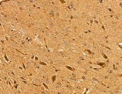 Invitrogen LIFR Polyclonal Antibody 100 &mu;L; Unconjugated:Antibodies,