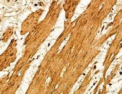 Invitrogen LIFR Polyclonal Antibody 100 &mu;L; Unconjugated:Antibodies,