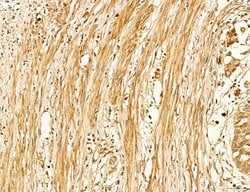 Invitrogen LIFR Polyclonal Antibody 100 &mu;L; Unconjugated:Antibodies,