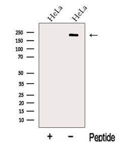 Invitrogen LIFR Polyclonal Antibody 100 &mu;L; Unconjugated:Antibodies,