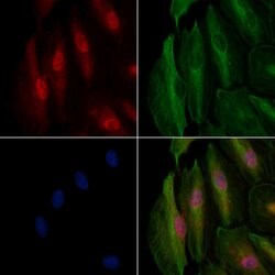 Invitrogen LIS1 Polyclonal Antibody 100 &mu;L; Unconjugated:Antibodies,