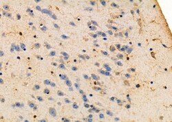 Invitrogen LIS1 Polyclonal Antibody 100 &mu;L; Unconjugated:Antibodies,