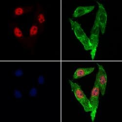 Invitrogen Lamin B2 Polyclonal Antibody 100 &mu;L; Unconjugated:Antibodies,
