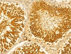 Invitrogen Lamin B2 Polyclonal Antibody 100 &mu;L; Unconjugated:Antibodies,