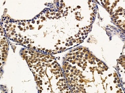 LOR Polyclonal Antibody:Antibodies, Polyclonal