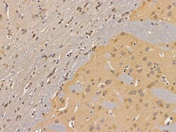 LOR Polyclonal Antibody:Antibodies, Polyclonal