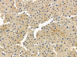 Invitrogen LSS Polyclonal Antibody 100 &mu;L; Unconjugated:Antibodies,