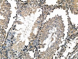 Invitrogen LY6K Polyclonal Antibody 100 &mu;L; Unconjugated:Antibodies,