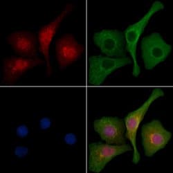 Invitrogen LZTR1 Polyclonal Antibody 100 &mu;L | Buy Online | Invitrogen&trade; | Fisher Scientific