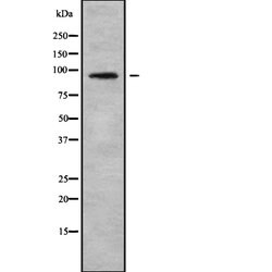 Invitrogen LZTR1 Polyclonal Antibody 100 &mu;L | Buy Online | Invitrogen&trade; | Fisher Scientific