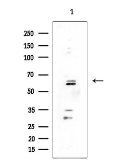 Invitrogen LZTR1 Polyclonal Antibody 100 &mu;L | Buy Online | Invitrogen&trade; | Fisher Scientific