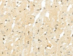 Invitrogen MACC1 Polyclonal Antibody 100 &mu;L; Unconjugated:Antibodies,