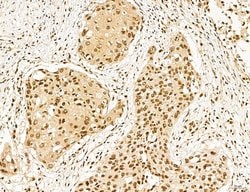 Invitrogen MACC1 Polyclonal Antibody 100 &mu;L; Unconjugated:Antibodies,
