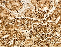 Invitrogen MACC1 Polyclonal Antibody 100 &mu;L; Unconjugated:Antibodies,