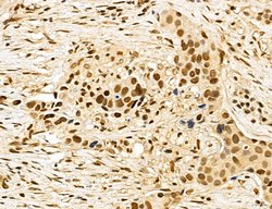 Invitrogen MACC1 Polyclonal Antibody 100 &mu;L; Unconjugated:Antibodies,