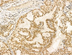 Invitrogen MACC1 Polyclonal Antibody 100 &mu;L; Unconjugated:Antibodies,