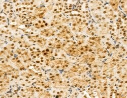 Invitrogen MACC1 Polyclonal Antibody 100 &mu;L; Unconjugated:Antibodies,