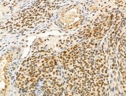 Invitrogen MACC1 Polyclonal Antibody 100 &mu;L; Unconjugated:Antibodies,