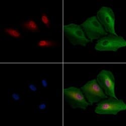 Invitrogen Histone Macro-H2A.1 Polyclonal Antibody 100 &mu;L; Unconjugated:Antibodies,
