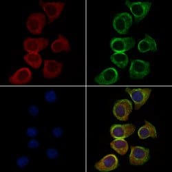 Invitrogen MAGEB1 Polyclonal Antibody 100 &mu;L; Unconjugated:Antibodies,
