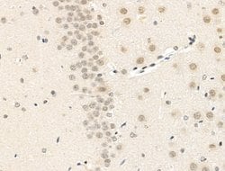MAML2 Polyclonal Antibody:Antibodies, Polyclonal