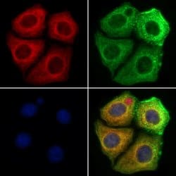 Invitrogen MAN2A1 Polyclonal Antibody 100 &mu;L; Unconjugated:Antibodies,