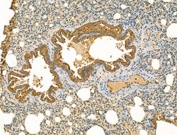 Invitrogen MAN2A1 Polyclonal Antibody 100 &mu;L; Unconjugated:Antibodies,