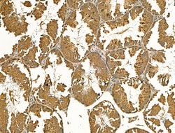 Invitrogen MAN2A1 Polyclonal Antibody 100 &mu;L; Unconjugated:Antibodies,