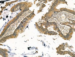 Invitrogen MAN2A1 Polyclonal Antibody 100 &mu;L; Unconjugated:Antibodies,