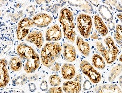 Invitrogen Monoamine Oxidase B Polyclonal Antibody 100 &mu;L; Unconjugated:Antibodies,