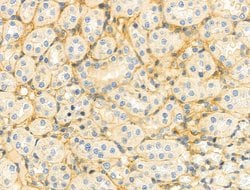 Invitrogen Monoamine Oxidase B Polyclonal Antibody 100 &mu;L; Unconjugated:Antibodies,