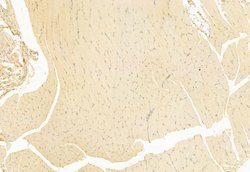 Invitrogen TPL2 Polyclonal Antibody 100 &mu;L; Unconjugated:Antibodies,